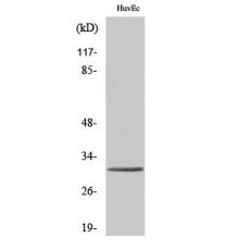 Anti-Tollip antibody