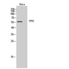 Anti-TPH2 antibody