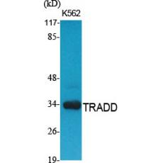 Anti-TRADD antibody