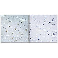 Anti-TRIP15 antibody