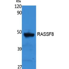 Anti-RASSF8 antibody