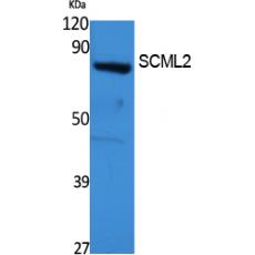 Anti-SCML2 antibody