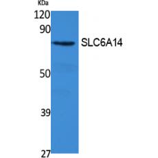 Anti-SLC6A14 antibody