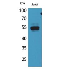 Anti-DPP7 antibody