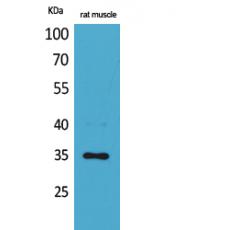 Anti-CA IV antibody