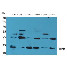 Anti-TRP14 antibody