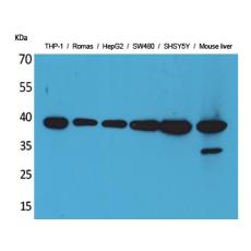 Anti-IL-10 antibody