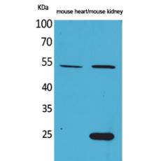 Anti-Sg III antibody