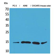 Anti-Eotaxin-3 antibody