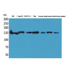 Anti-IL-16 antibody