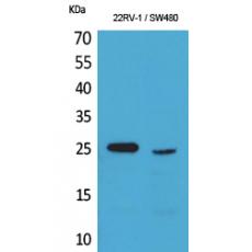 Anti-SSX antibody