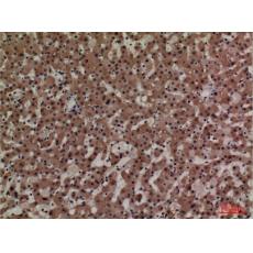 Anti-ADM antibody