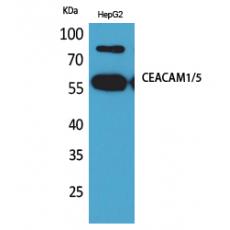 Anti-CEACAM1/5 antibody