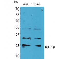 Anti-MIP-1β antibody