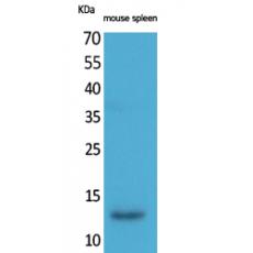 Anti-BLC antibody