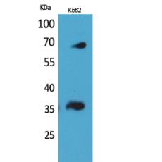 Anti-CD32-B/C antibody