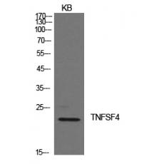 Anti-Ox40L antibody