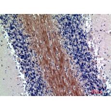 Anti-SIRP-α1/β1 antibody