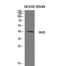 Anti-CD240d antibody