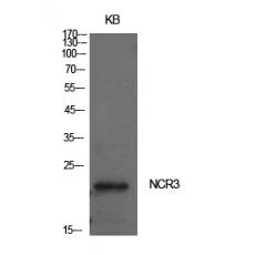 Anti-NKp30 antibody