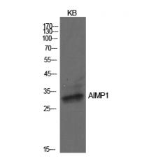 Anti-EMAP II antibody
