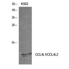 Anti-MIP-1b antibody