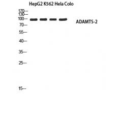Anti-ADAMTS-2 antibody