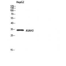 Anti-ASAH3 antibody