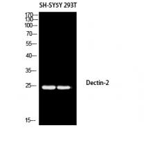 Anti-Dectin-2 antibody