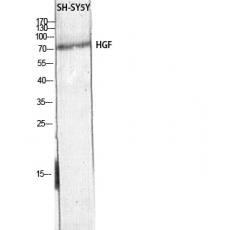 Anti-HGF antibody