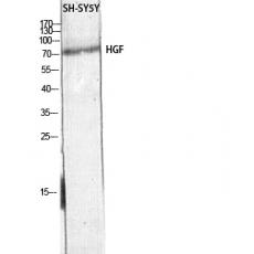 Anti-HGF antibody