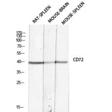 Anti-CD72 antibody