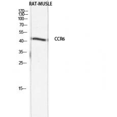 Anti-CKR-6 antibody