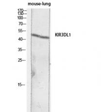 Anti-CD158e antibody