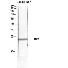 Anti-CD306 antibody