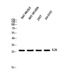 Anti-IL-26 antibody