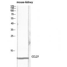 Anti-CTACK antibody