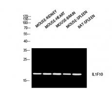 Anti-IL-1F10 antibody