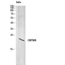 Anti-CMTM8 antibody