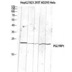 Anti-PGLYRP1 antibody