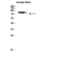 Anti-CD238 antibody