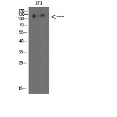 Anti-Hamartin antibody