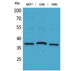 Anti-CD79b antibody