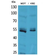 Anti-CD85e/h antibody