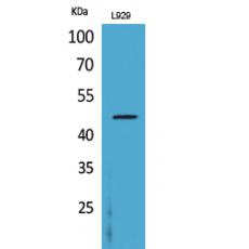 Anti-CD116 antibody
