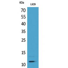 Anti-MCP-2 antibody