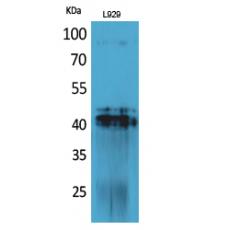 Anti-PDGF-D antibody