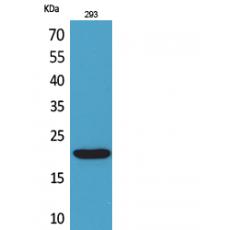 Anti-CMTM6 antibody