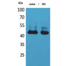 Anti-SCCA1/2 antibody