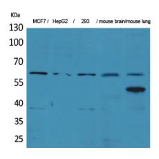 Anti-ZKSCAN4 antibody